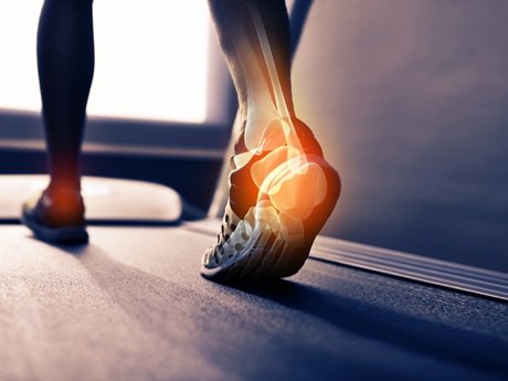 Injury Prevention for Runners: Essential Tips 